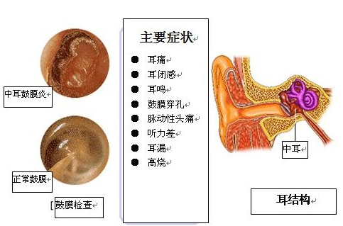 [中耳炎]耳朵痒有黄液体流出，怎么治疗